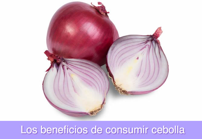 Cebolla